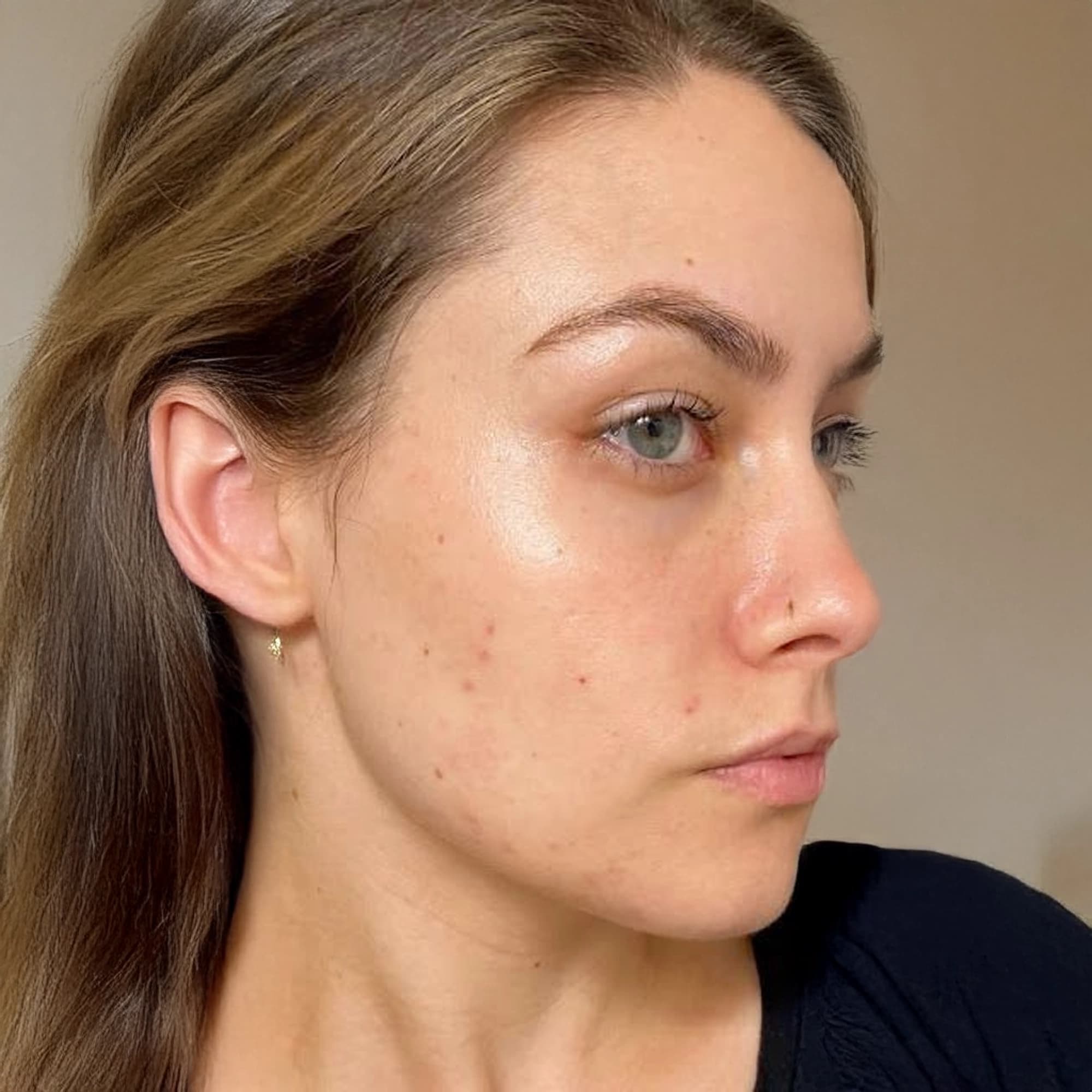 Before treatment
